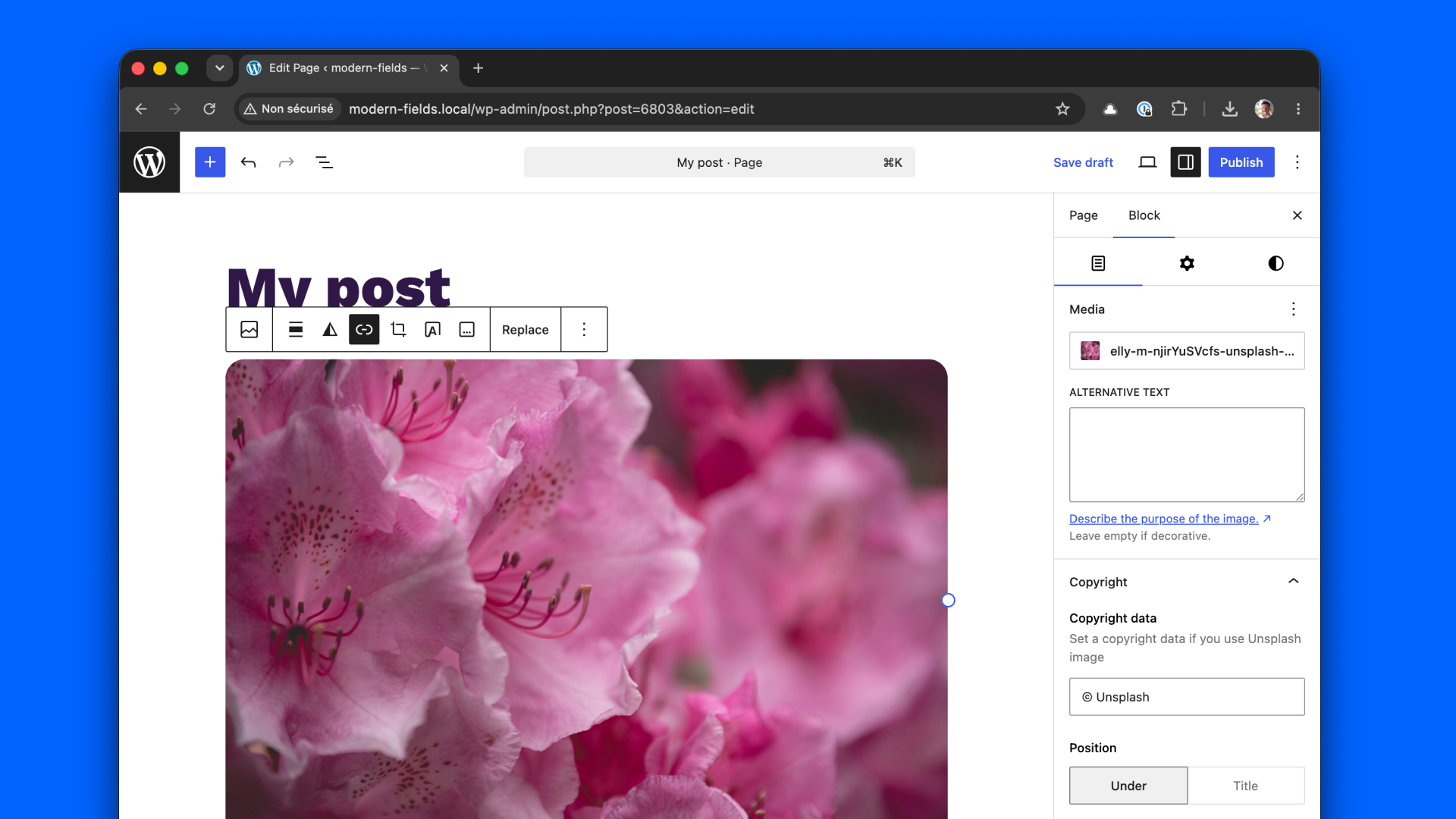Custom fields for the image block in the content tab.